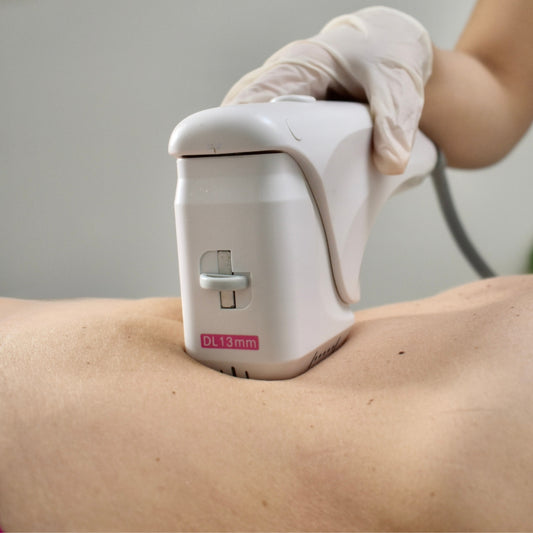 HIFU PROTOCOLLO CORPO