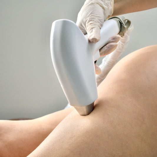 EPILAZIONE LASER STARDUST MED
