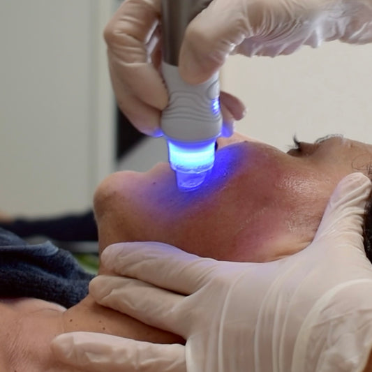 HYDRAFACIAL